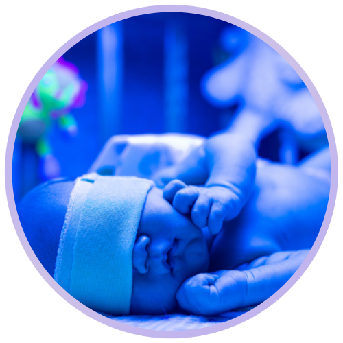 Icterícia Neonatal